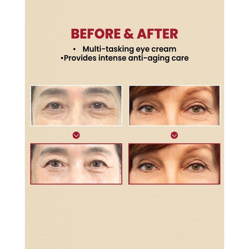 K-SECRET SEOUL 1988 Eye Cream : Retinal Liposome 4% + Fermented Bean